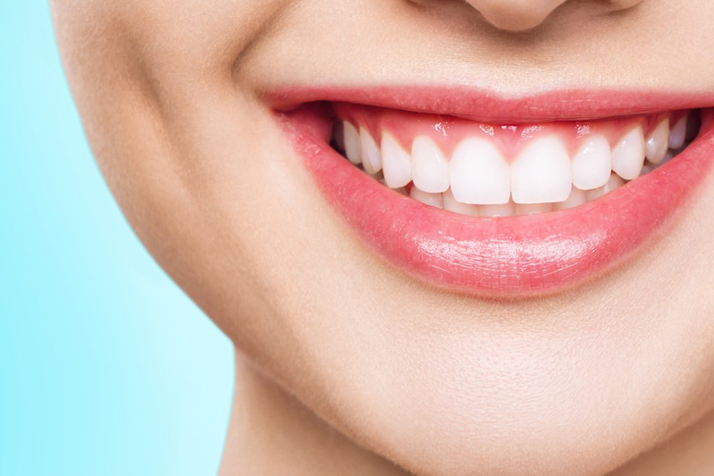 The Secret to a Brighter Smile: Why Teeth Whitening Could Be Your Next Step
